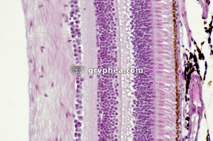 Rétine - vue d'ensemble montrant les photorécepteurs (cônes et bâtonnets) et la structure histologique CT x100 - gryphea.org